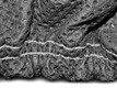 Elastic Tensioners