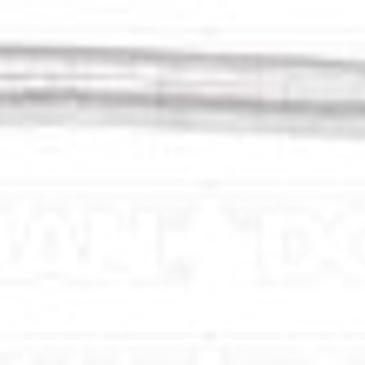 Dorman® - OE Solutions™ Turbocharger Coolant Line